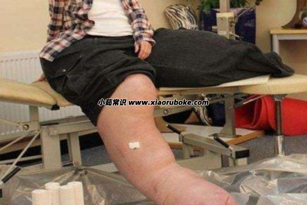 世界上最丑的腿图片，世界上最丑的五种腿型-第1张图片-阔酒网