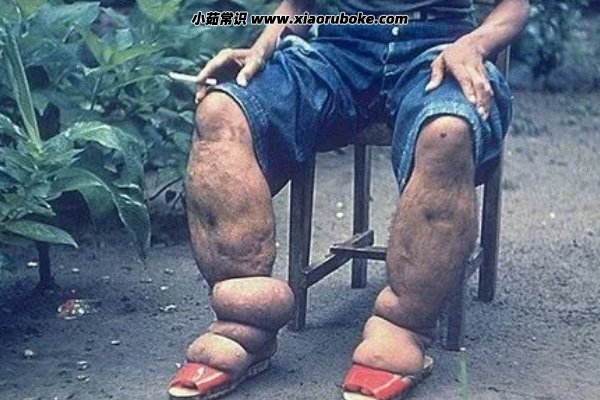 世界上最丑的腿图片，世界上最丑的五种腿型-第2张图片-索考网